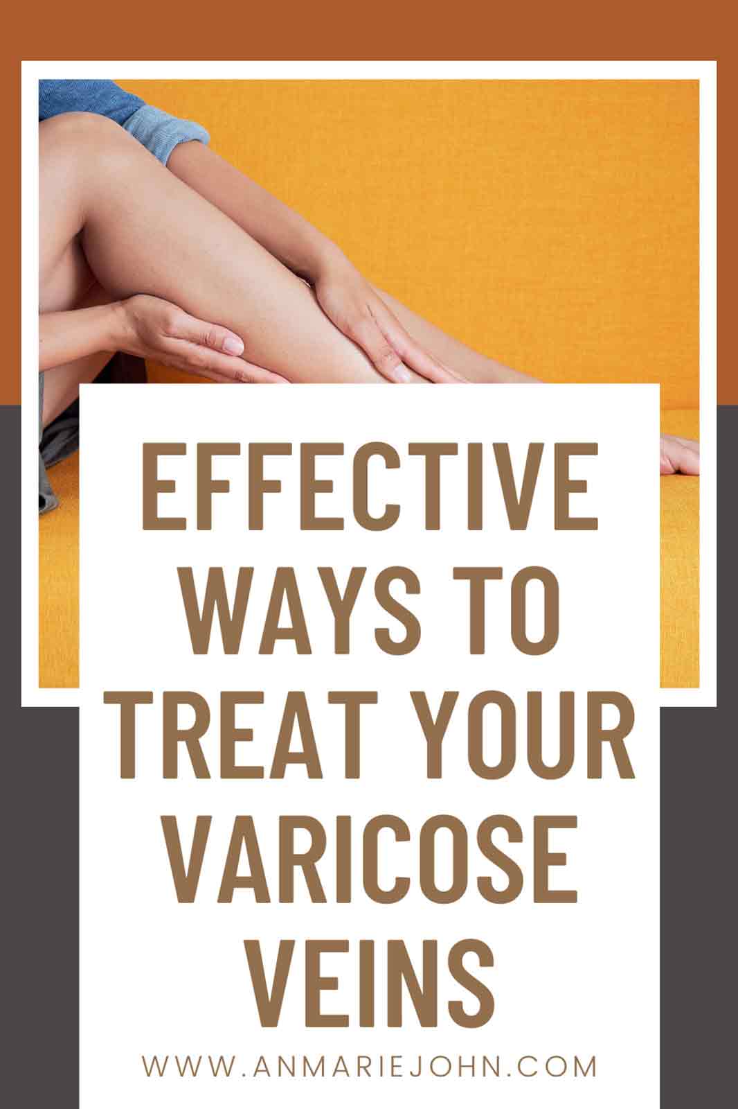 Effective Ways to Treat Your Varicose Vein Problem