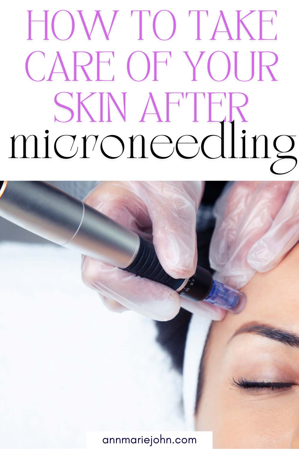 How to Take Care of Your Skin After Microneedling